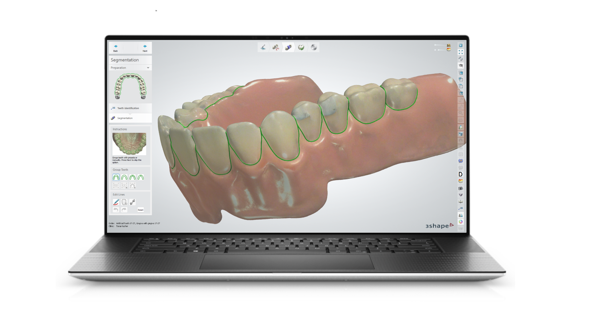 Dental System 3D modeling interface